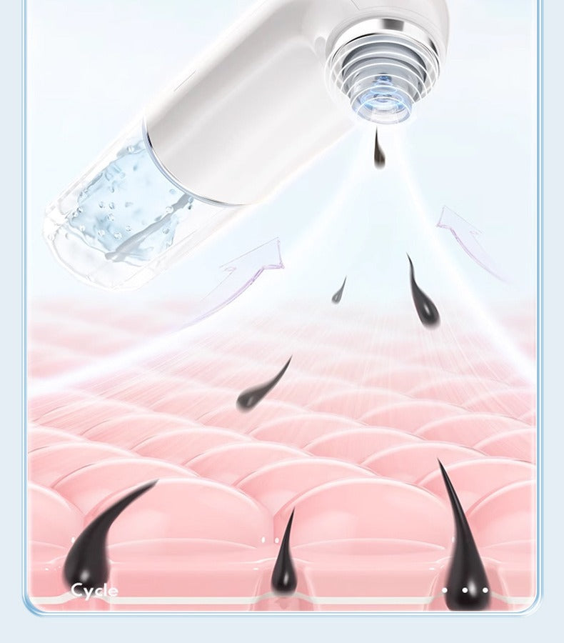 Electric blackhead remover pore vacuum by Glow Ritual